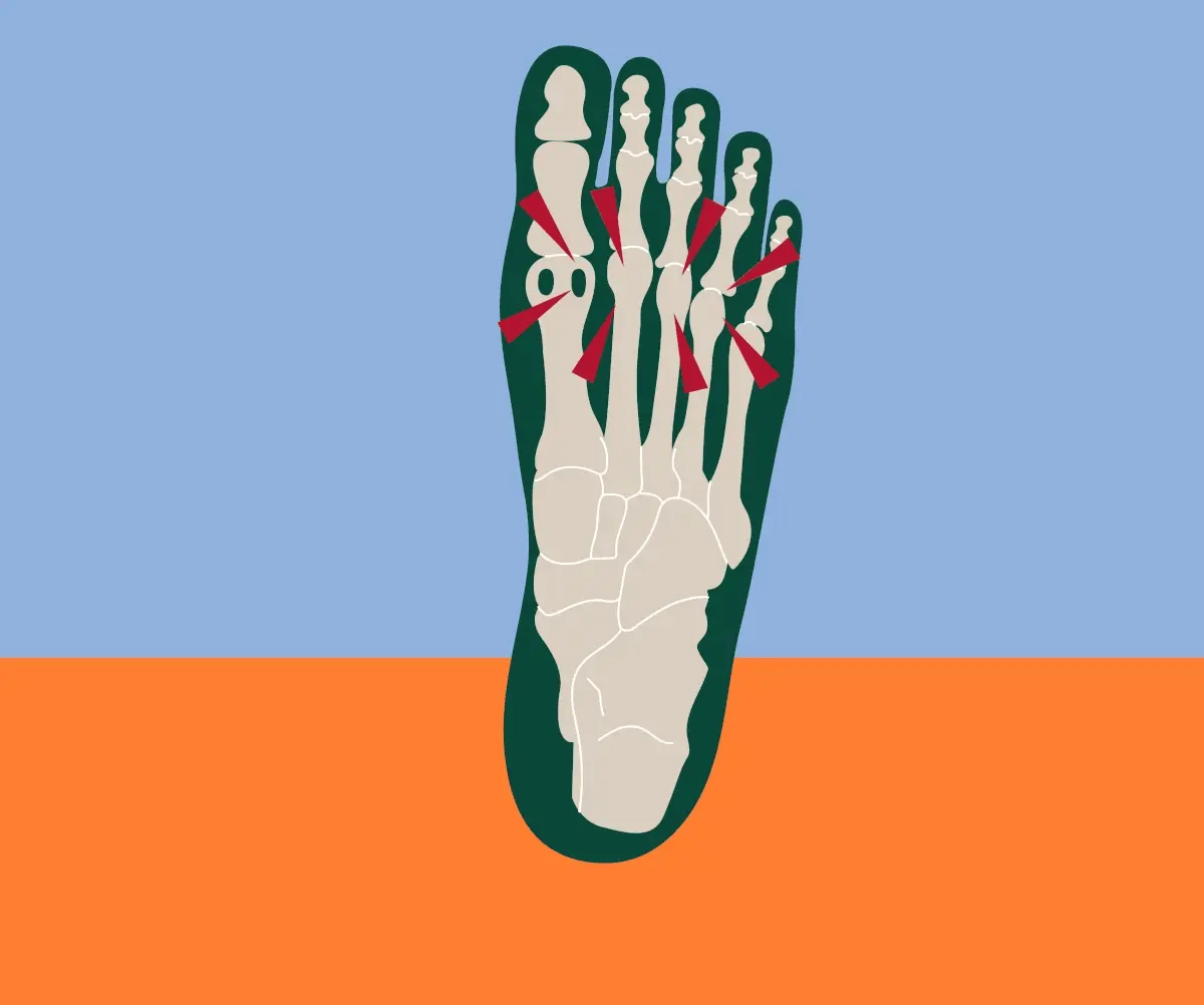 ofreischuhe_orthopedic_shoes_support_pain_relief_feet_healthy_shoes