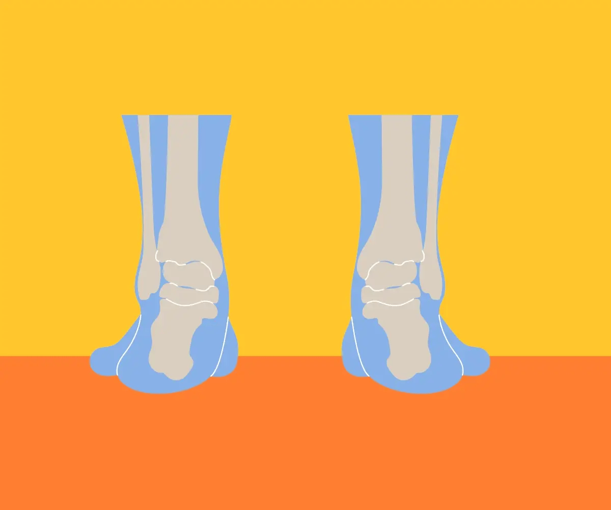 ofreischuhe_orthopedic_shoes_support_pain_relief_feet_healthy_shoes